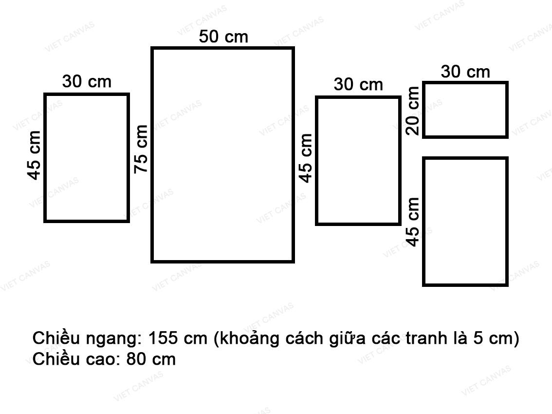 Bộ 5 Tranh Dứa Và Lá Cây Xanh - VY039.2